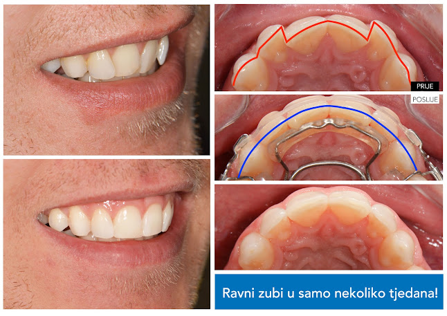 Prije i poslije dentalnog rada